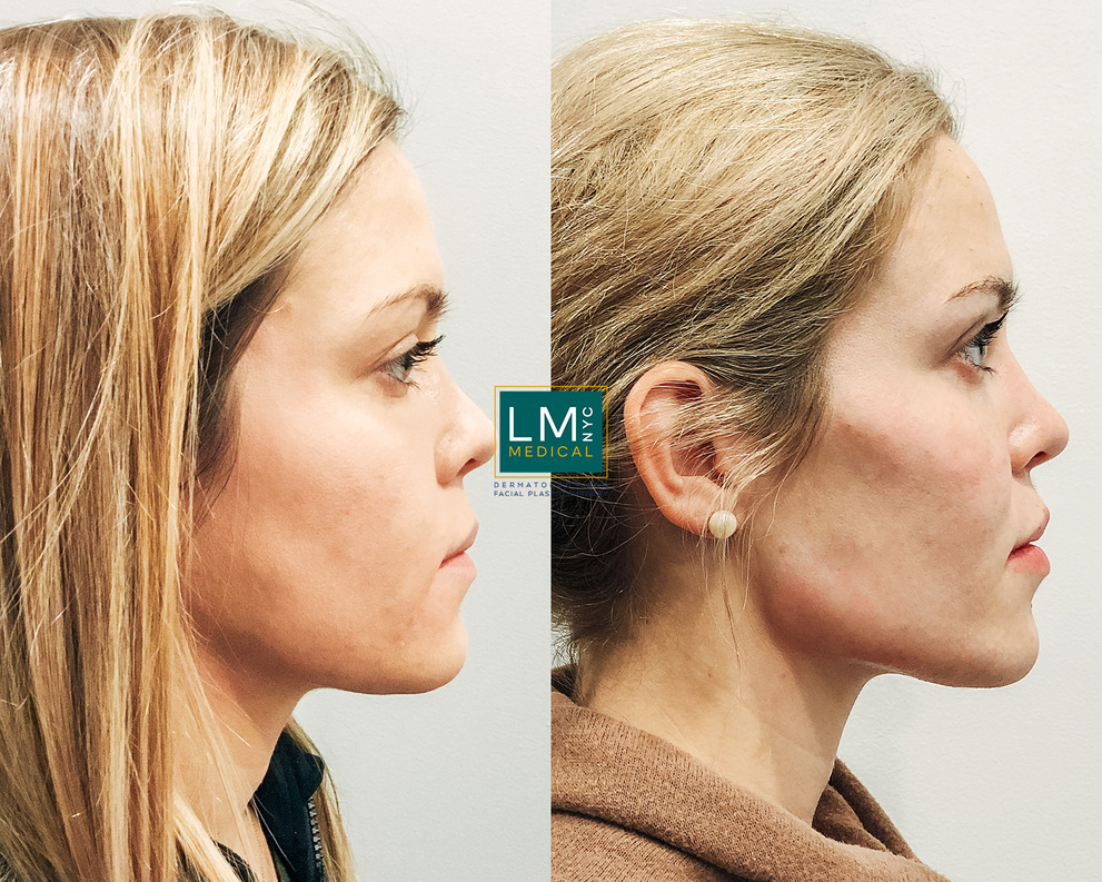 90B85607-8C5F-49AB-8852-8CED4CA5CD12_1_105_c