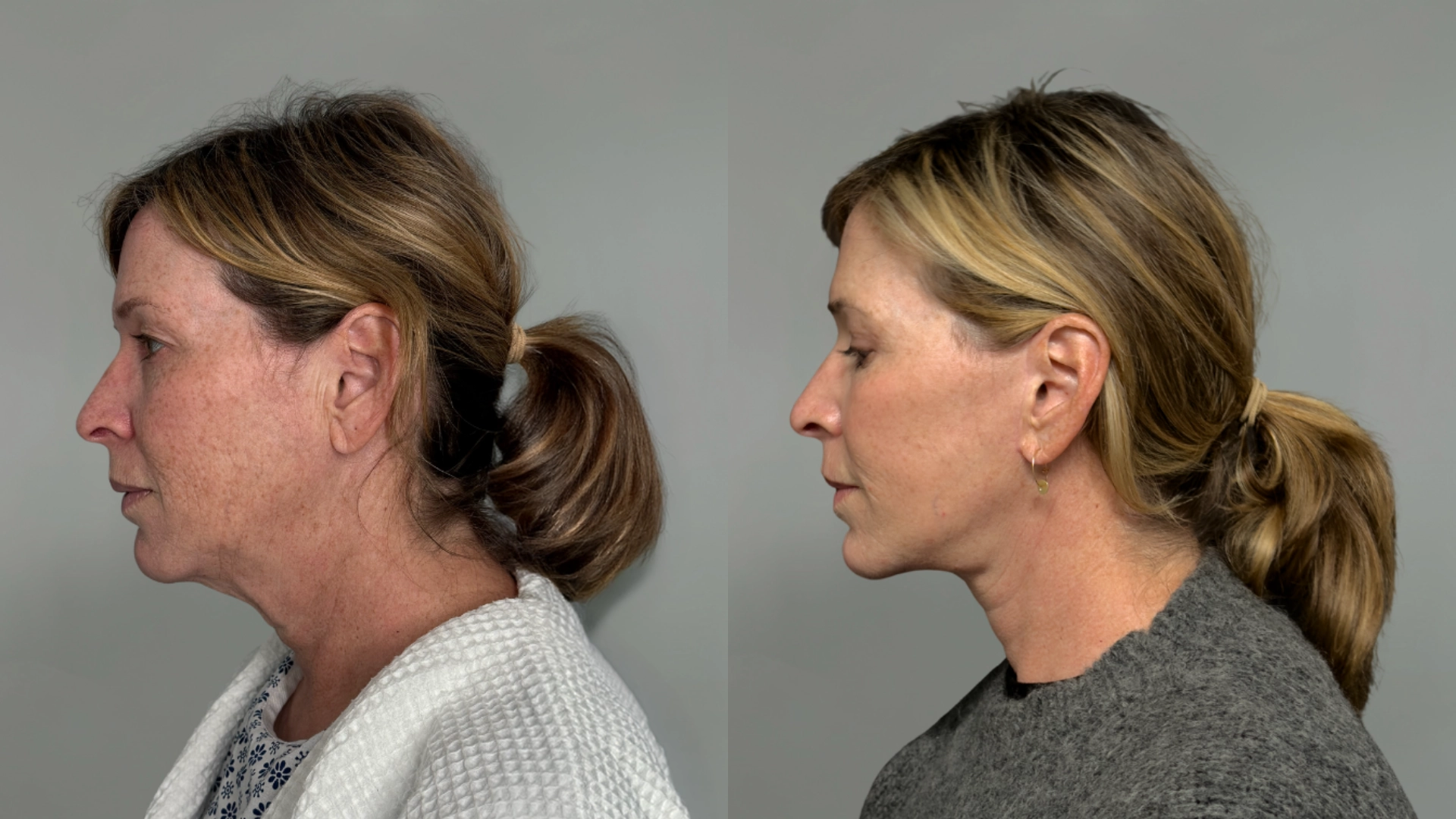 FL_020_2025_SideBySide_SideLeft